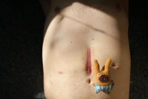 Justin's Scars with Something Cute